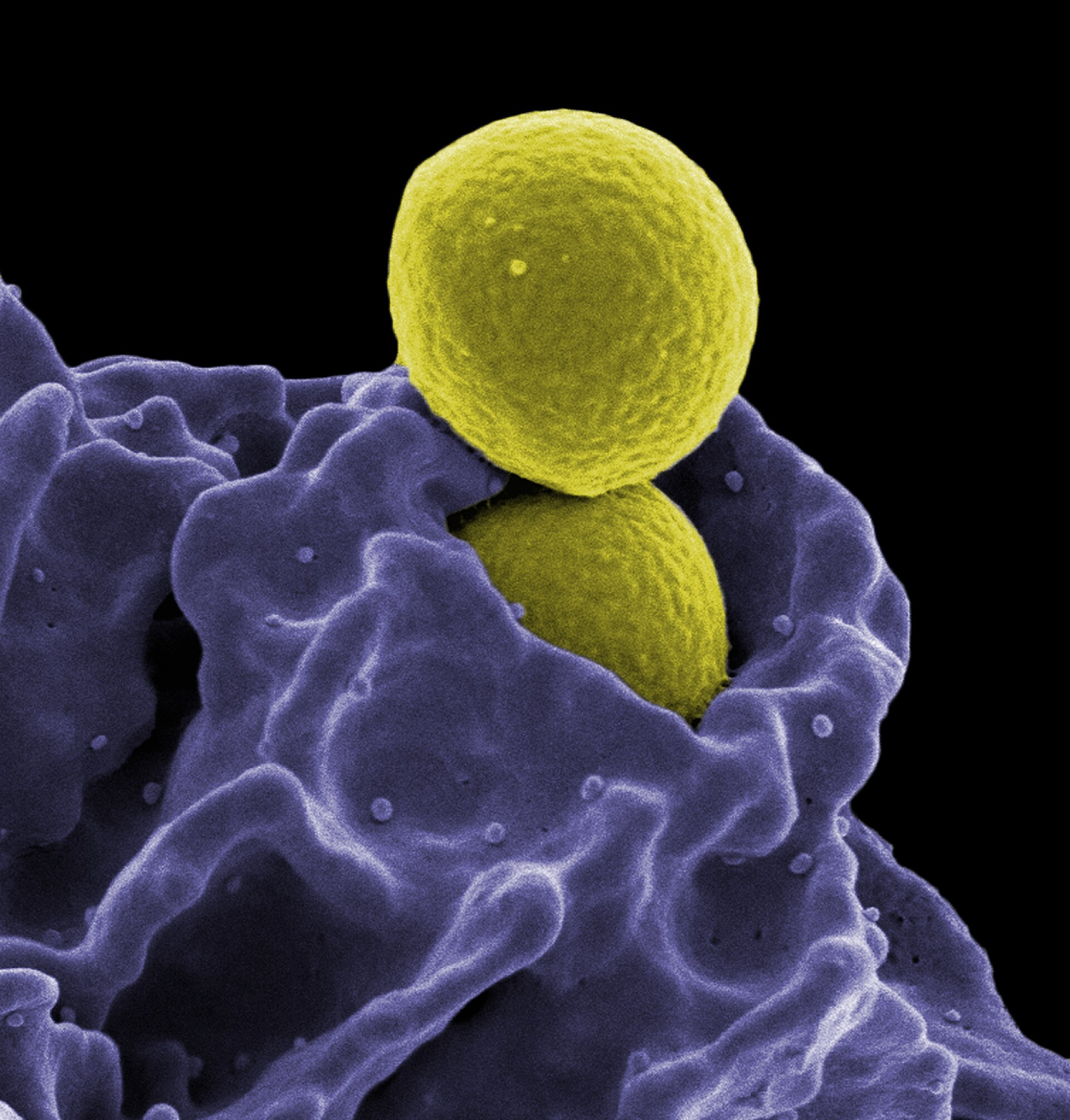 MRSA, Ingestion by Neutrophil