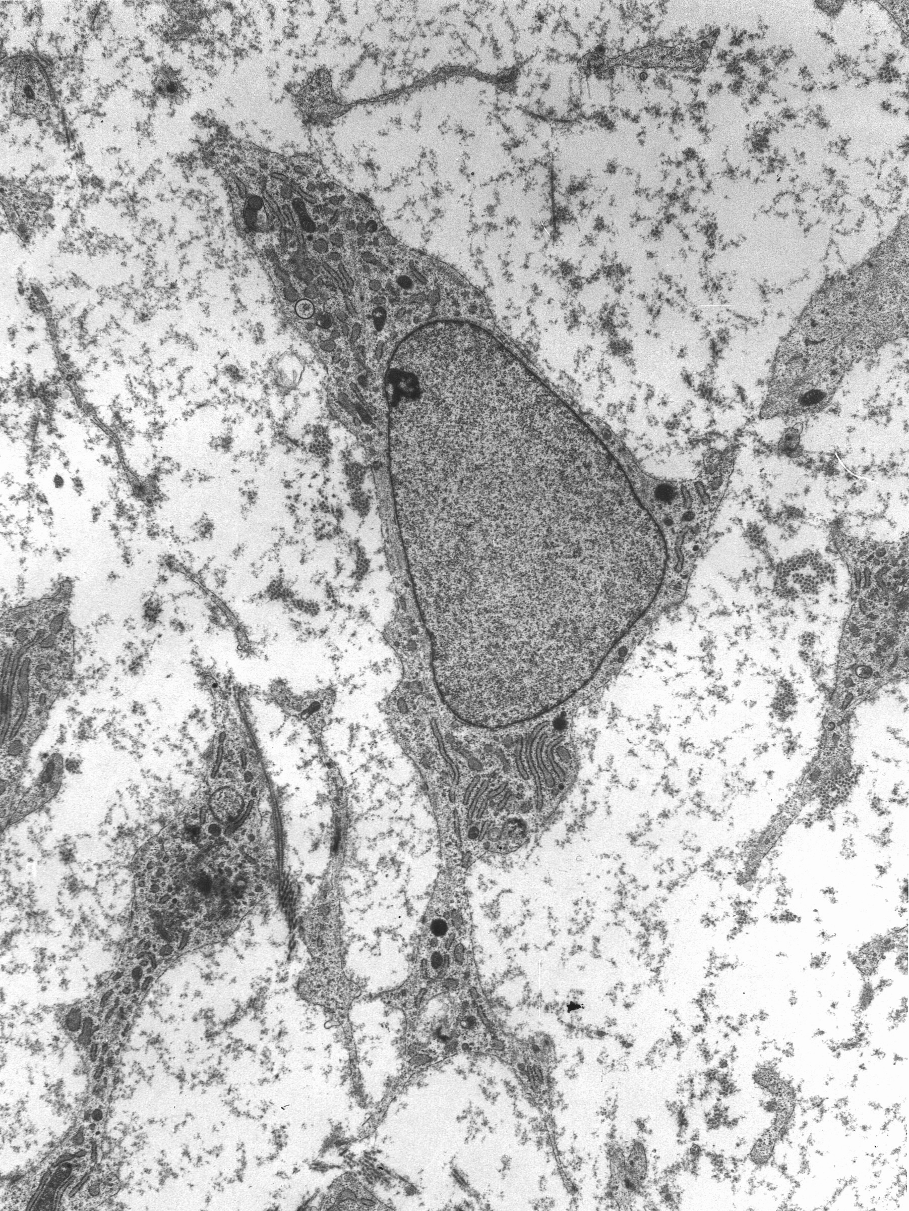 MSC high magnification